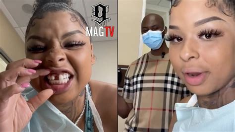 why does chrisean rock have a missing tooth|Chrisean Rock Fixes Missing Tooth As New Baby Bump Photos。